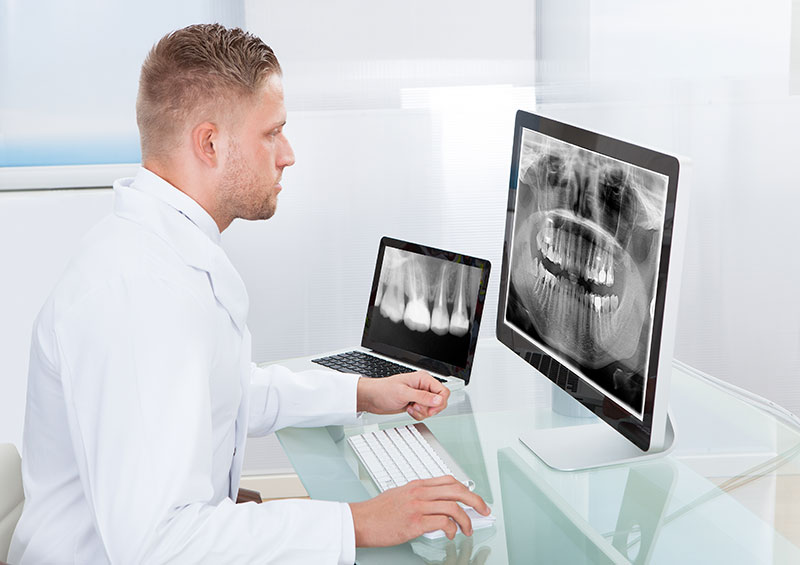 dental x-rays mississauga dentist cawthra dental