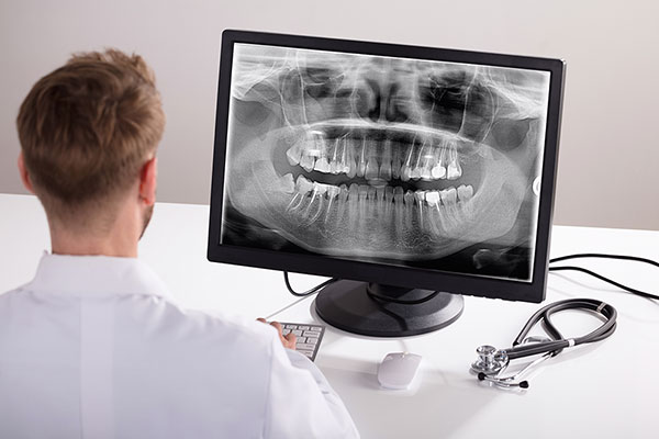 Why Does Your Dentist Need Dental X-Rays? | Cawthra Dental