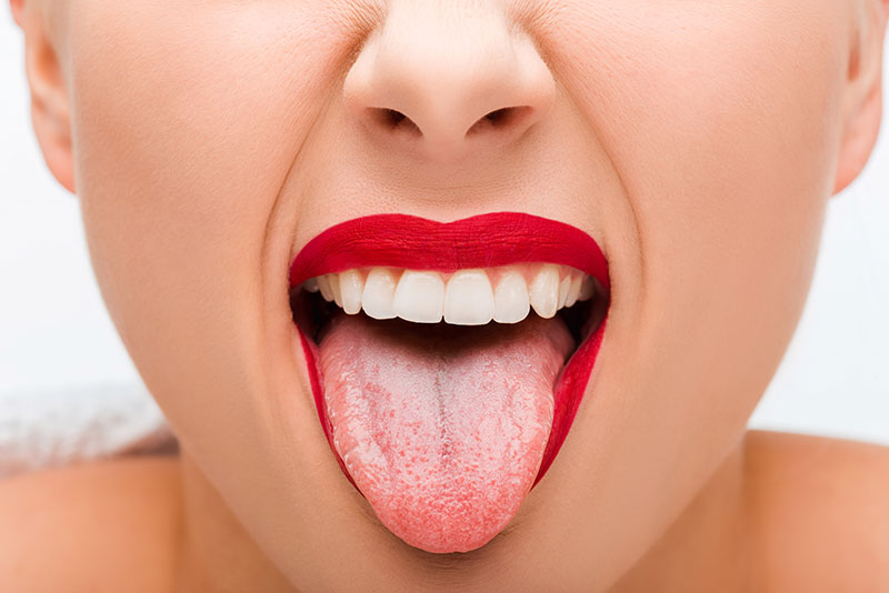 how to clean a white tongue