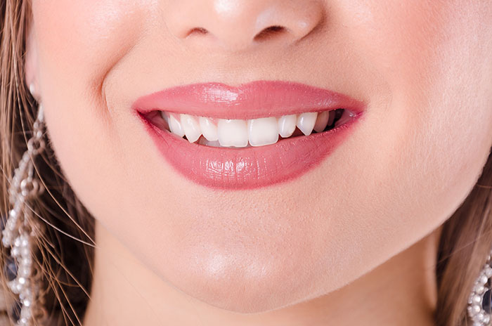 Treatment of Peg Shaped Teeth